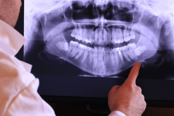 Best Emergency Dental Care for Sports Injuries in Baldwyn, MS